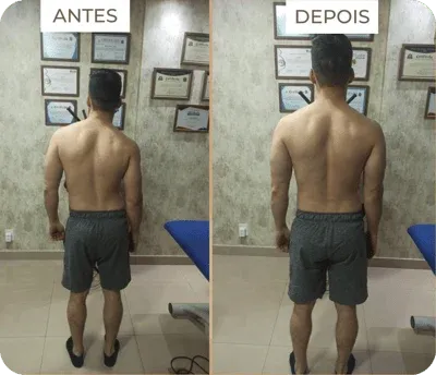 Antes e depois da primeira sessão