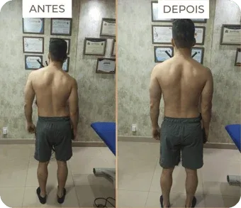 Antes e depois da primeira sessão